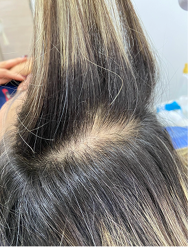 Cabellos debilitados o con ruptura por químicos o malos procedimientos