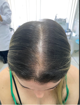 Mujeres en postparto (desde el mes 5)