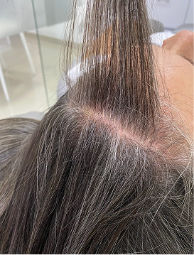 Personas con caída activa