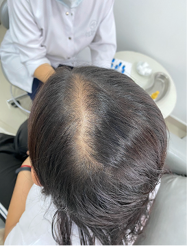 Personas que desean estimular crecimiento